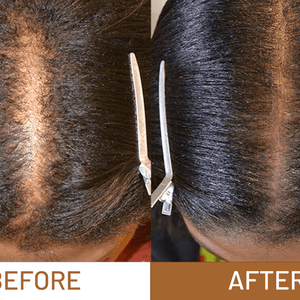 Huile capillaire Batana NourishHair