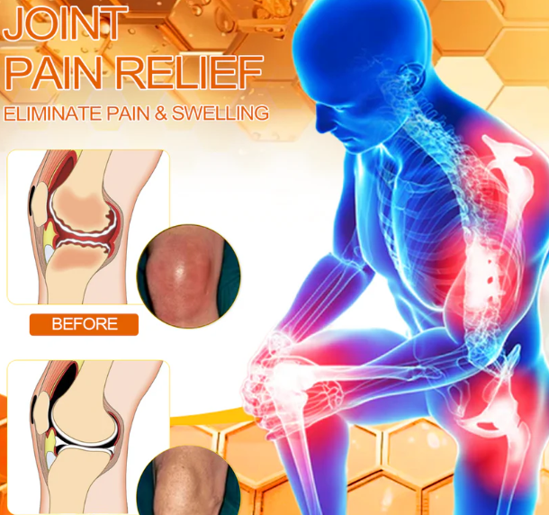 Venin d'abeille - Crème de traitement contre tous types de douleurs musculaires