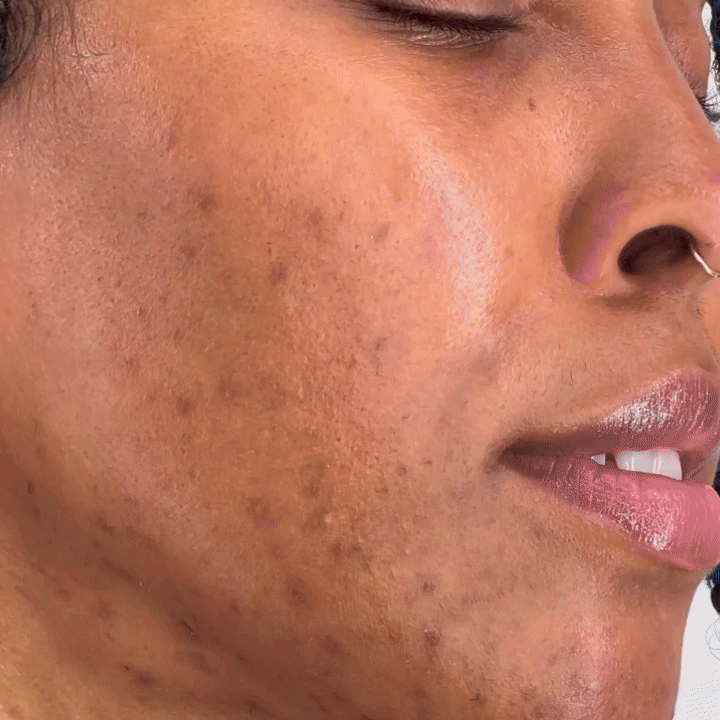 Masque de Nuit Enveloppant au Curcuma et à l'Acide Kojique