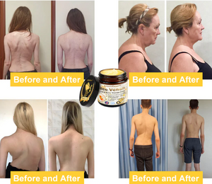 Venin d'abeille - Crème de traitement contre tous types de douleurs musculaires