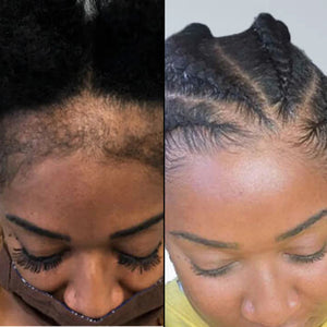 Huile capillaire Batana NourishHair