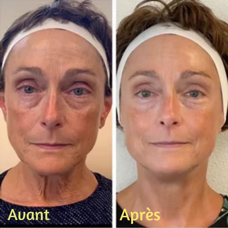 Crème Anti-Cernes & Rides Instantanée – Regard Jeune en 90 Secondes